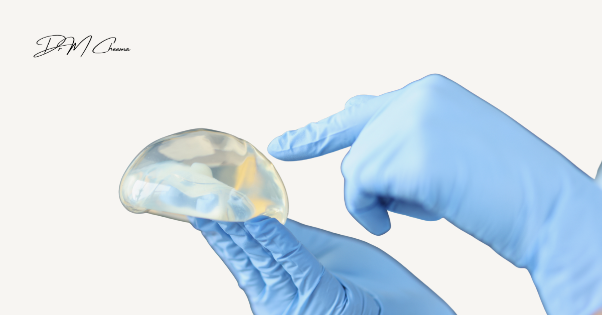 Navigating Breast Implant Revision