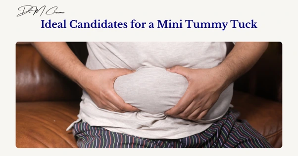 Candidates for a Mini Tummy Tuck