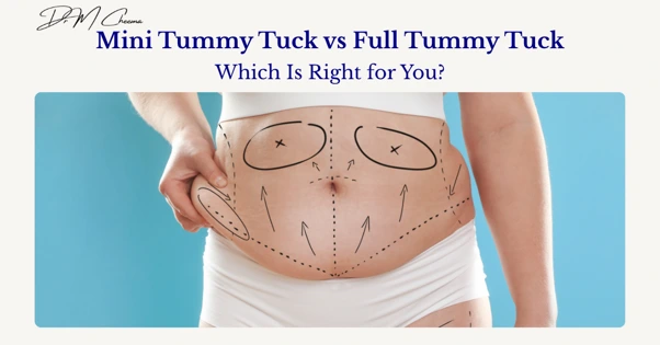 Mini Tummy Tuck
