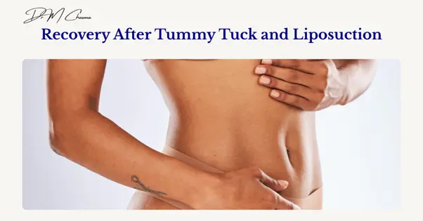 After Tummy Tuck and Liposuction