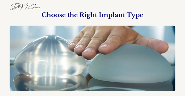 Choose the Right Implant Type