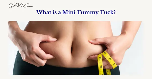Mini Tummy Tuck