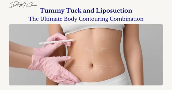 Tummy Tuck and Liposuction