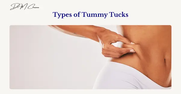 Tummy Tucks