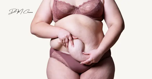 tummy tuck