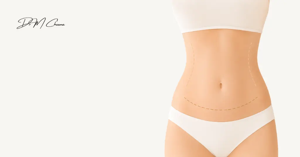 Tummy Tuck Cost UK