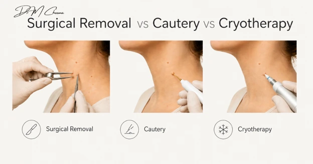 Surgical Removal