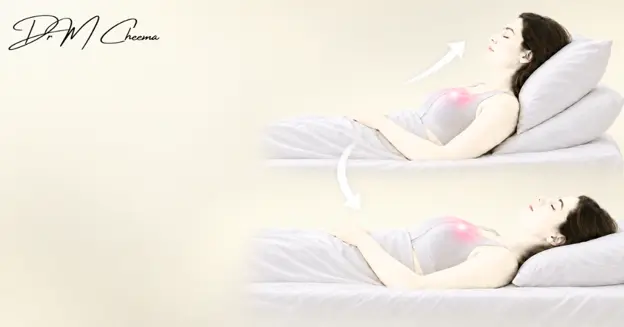 Sleep Flat After Breast Reduction